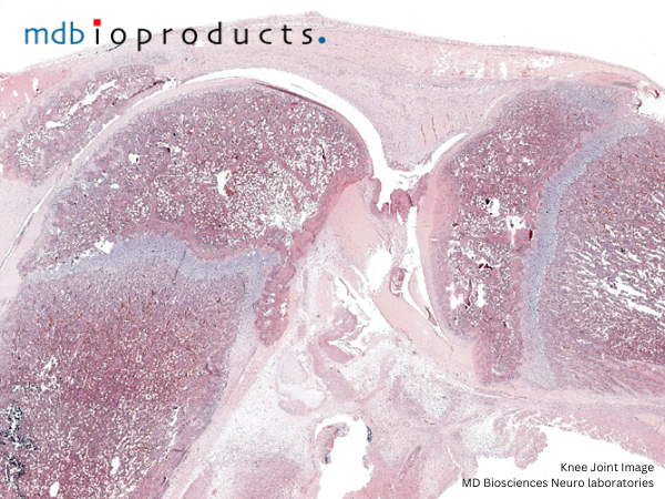 Featured Publication in Focus: Additive Efficacy of a Bispecific Anti–TNF/IL-6 Nanobody Compound in Translational Models of Rheumatoid Arthritis