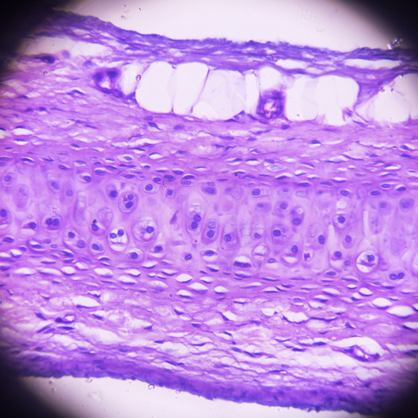 Cartilage & Aggrecan