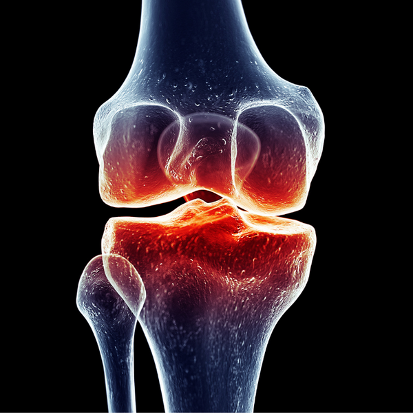 Inflammation