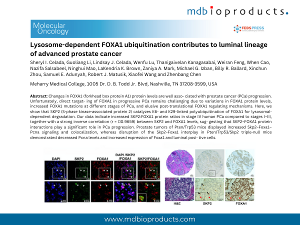 Featured Publication in Focus: Lysosome-dependent FOXA1 ubiquitination contributes to luminal lineage of advanced prostate cancer