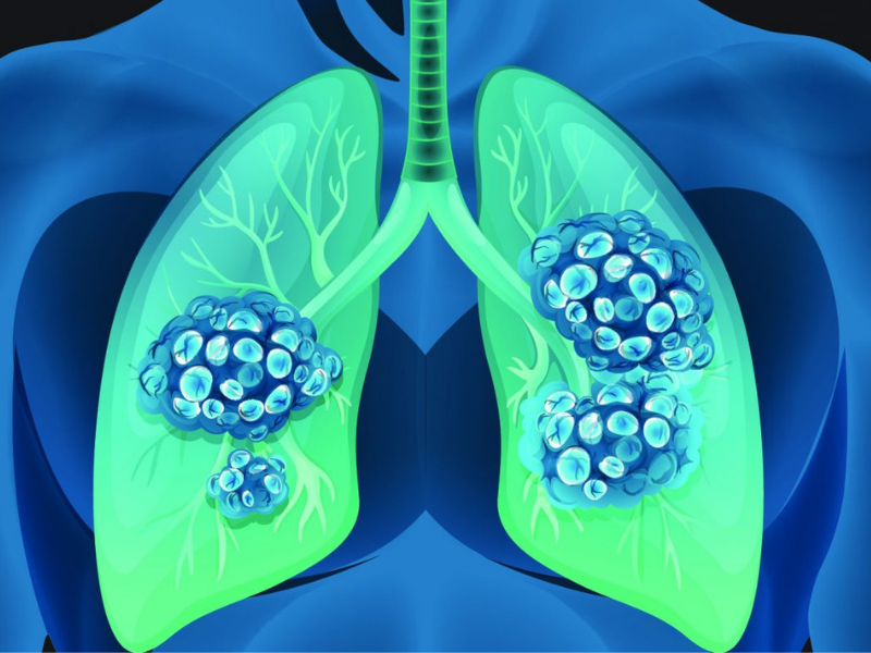 IgE Mediated Respiratory Immune Response